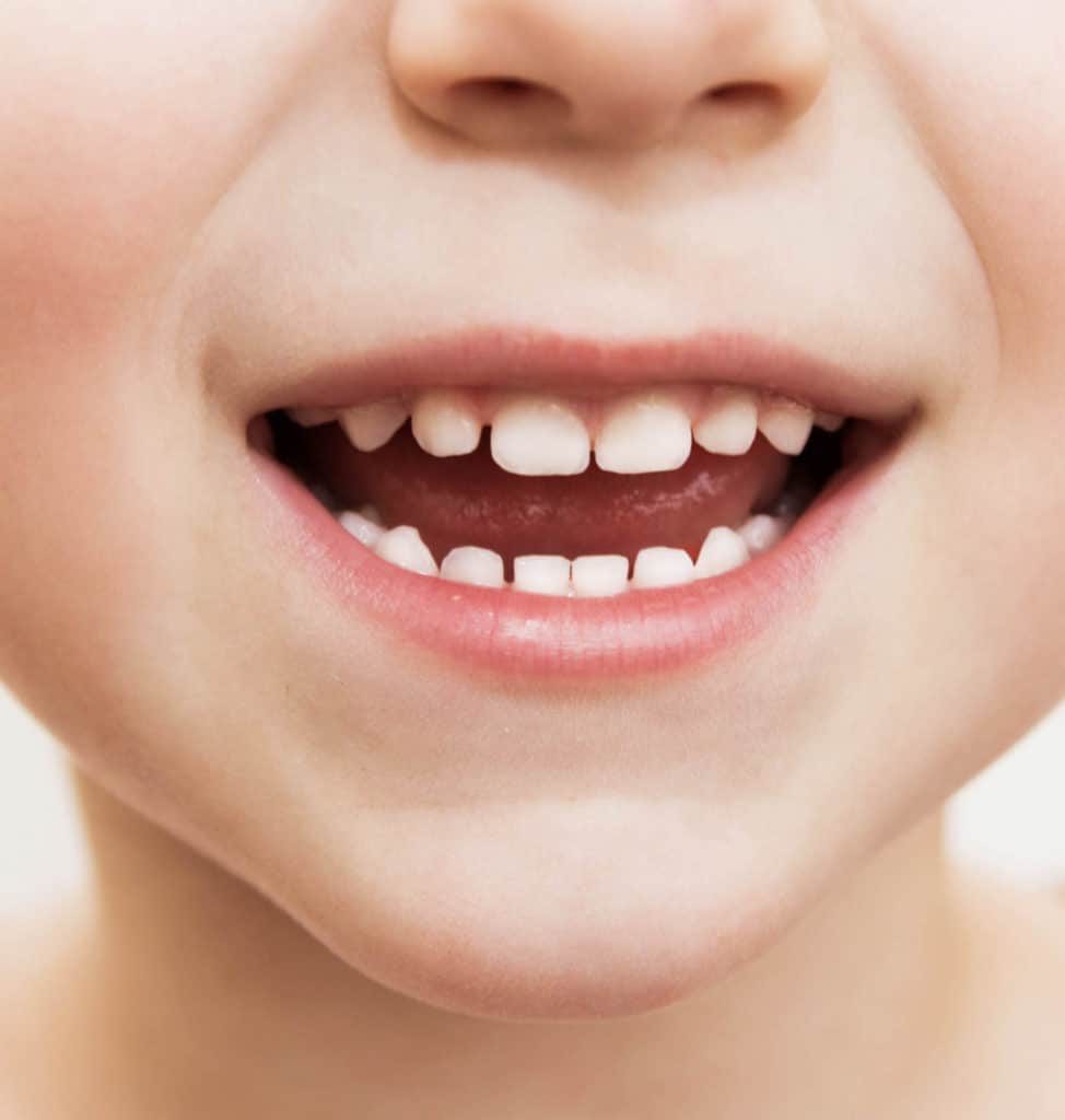Dr. Laura Mitchell. Frisco Mini Molars Pediatric Dentistry. Oral Sedation, Frenectomy, Oral Appliances, 1st Baby Visits, Emergency Dentistry, Mouthguards, Fracture Repair, White Crowns & Fillings, Pediatric Dentistry. Pediatric Dentist in Frisco, TX75033