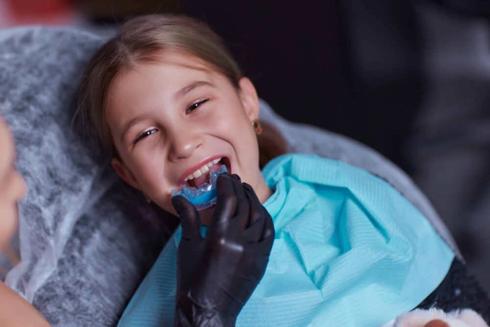 mouthguards frisco